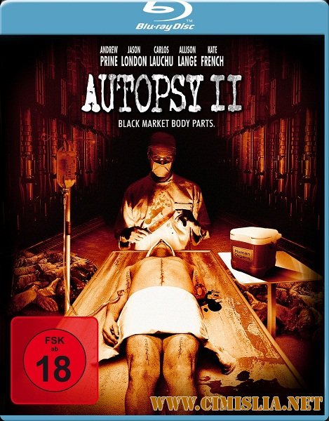 Швы / Sutures [2009 / HDRip]