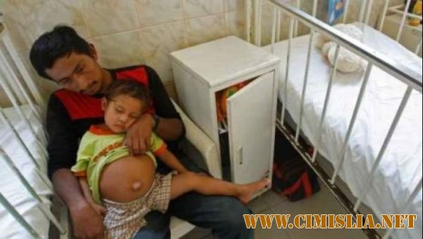 Caz socant in Peru. Baietel in varsta de 3 ani, insarcinat cu fratele sau geaman