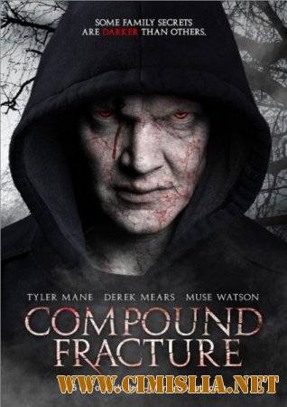 Открытый перелом / Compound Fracture [2013 / WEB-DLRip]