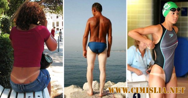 20 людей, чей загар явно не удался